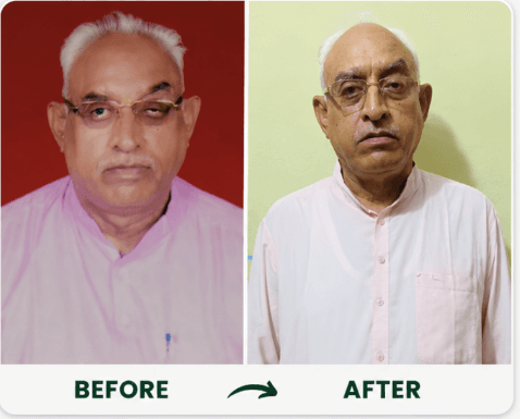 Girish Sharma transformation