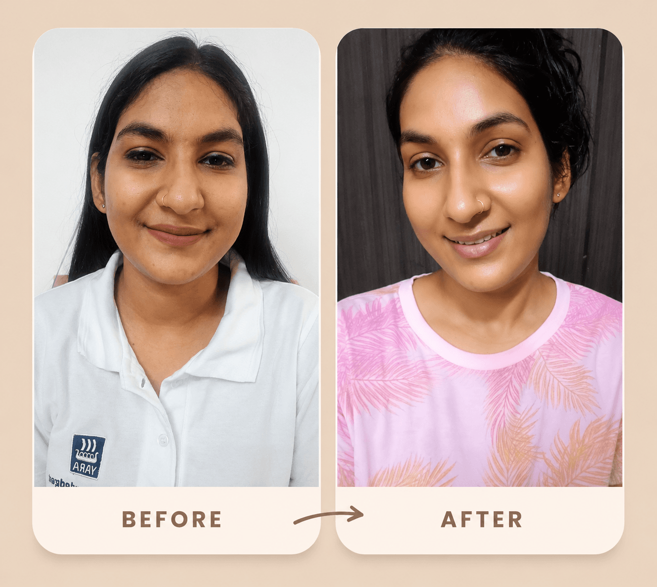 Vaishali Jain transformation